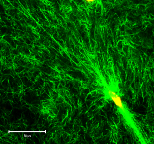 Fibroblast in a 3D collagen matrix